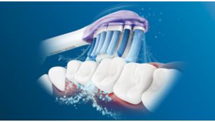 Napredna sonična tehnologija Philips Sonicare