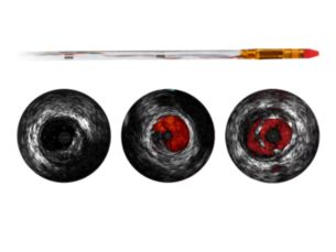 Eagle Eye Platinum ST Digital IVUS short tip catheter